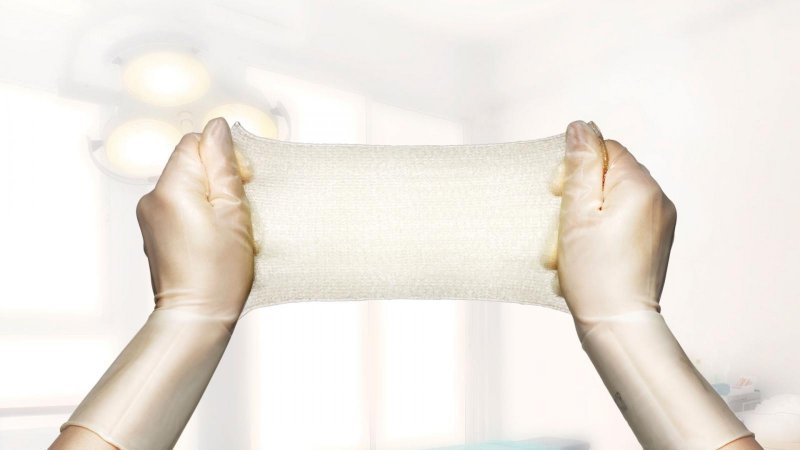 Exufiber - 1 x 45 cm, 5 ks - Vysoce absorpční krytí z hydrovlákna