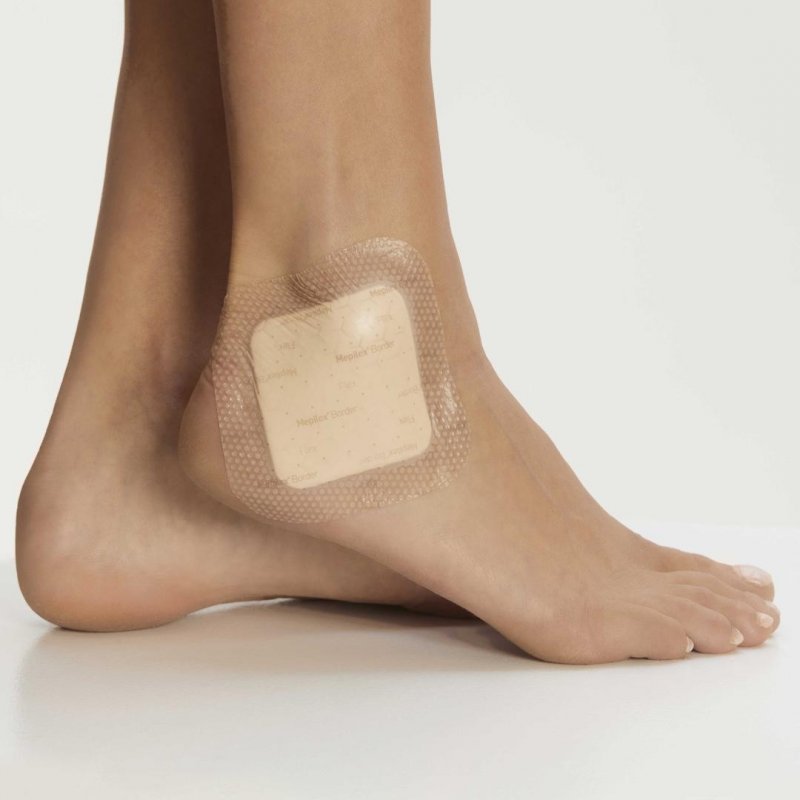 Mepilex Border Flex Lite - 4 x 5 cm - Tenké samolepící pěnové krytí se silikonovou vrstvou, 10 ks