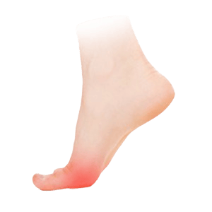 Bolest předonoží